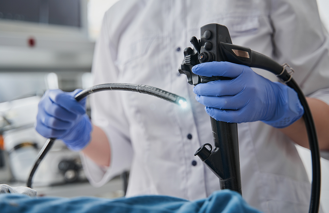 Endoscopia