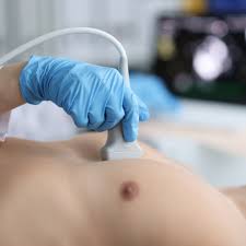 Ecocardiograma