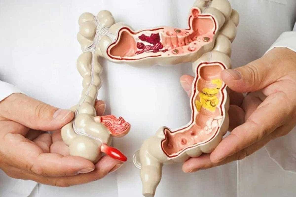 Coloproctologia